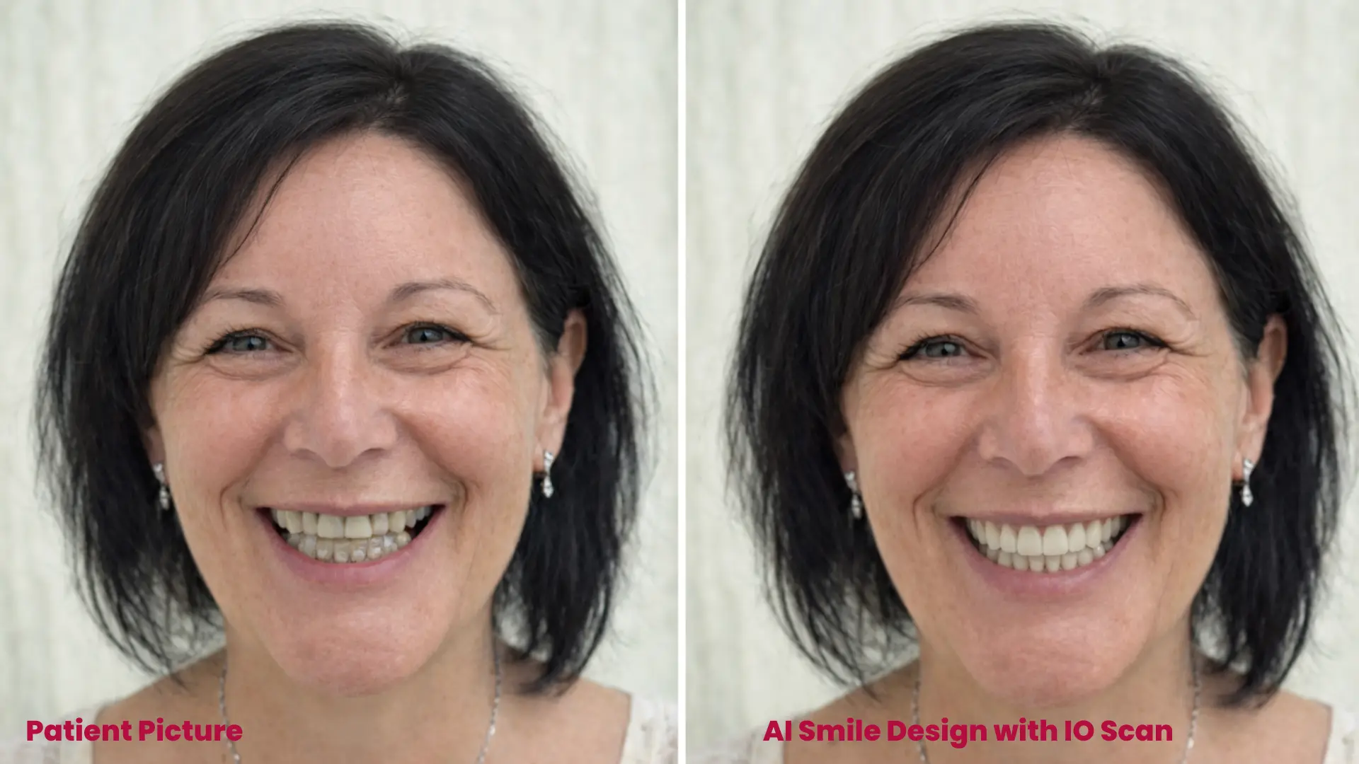 Smile Vector Machine Learning SmileFy — AI Smile Design & 3D Treatment Planning