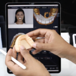 A Guide to Creating 3D Digital Dental Wax-ups In-Office